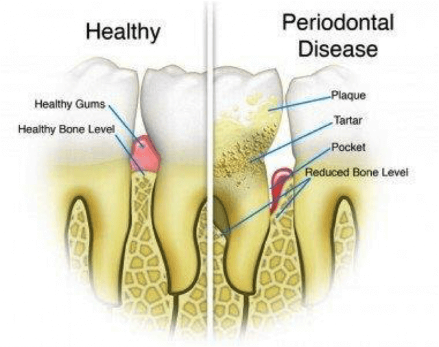 oral-health-tip-2