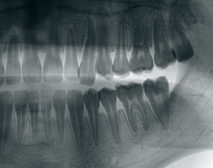 https://www.smilecharlotte.com/wp-content/uploads/2023/01/teeth-xray-300x237-1.png