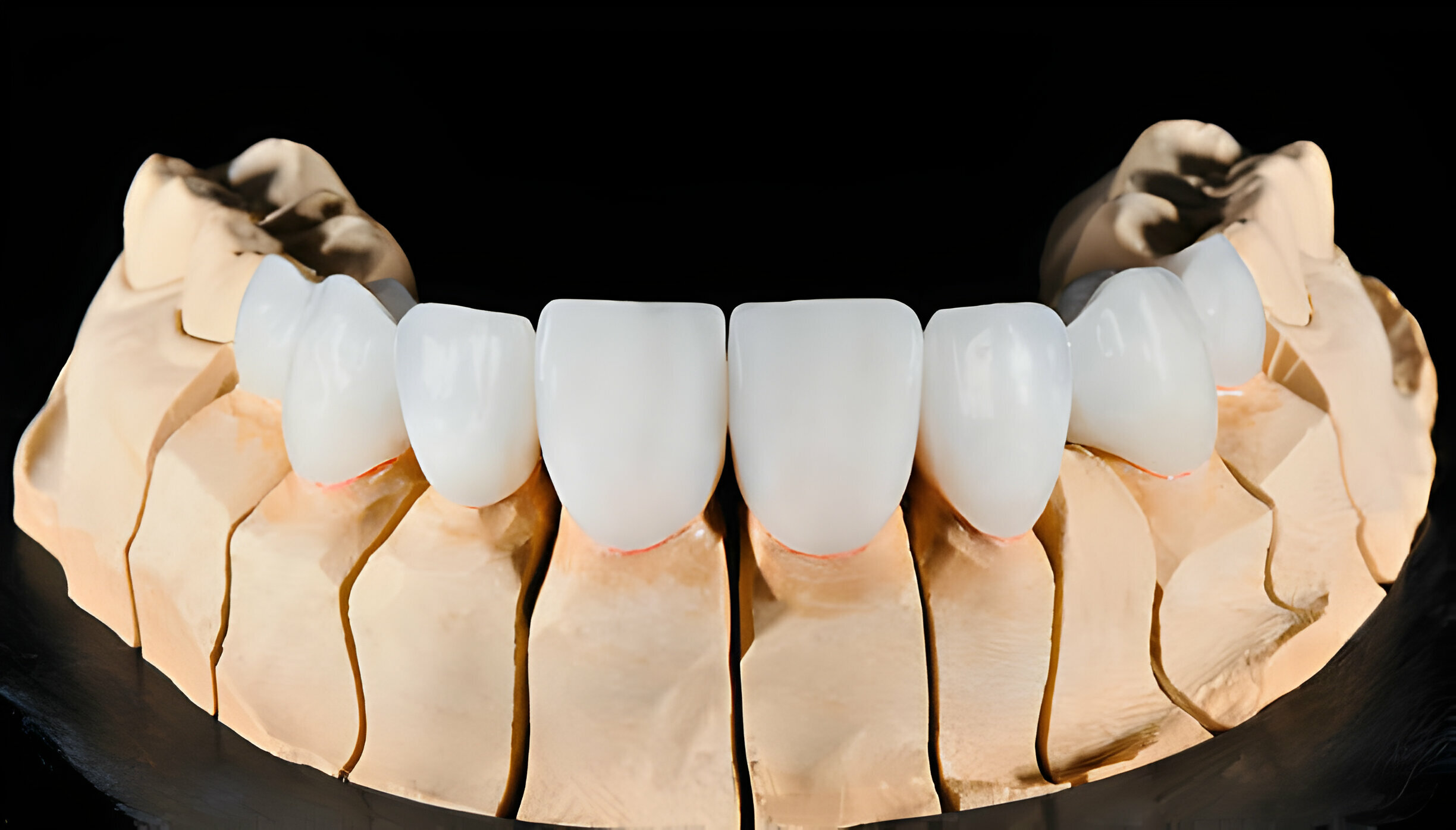 Why Should You Choose Charlotte Dental Esthetics?_1