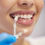 The Benefits of Same-Day Veneers for a Stunning Smile Transformation